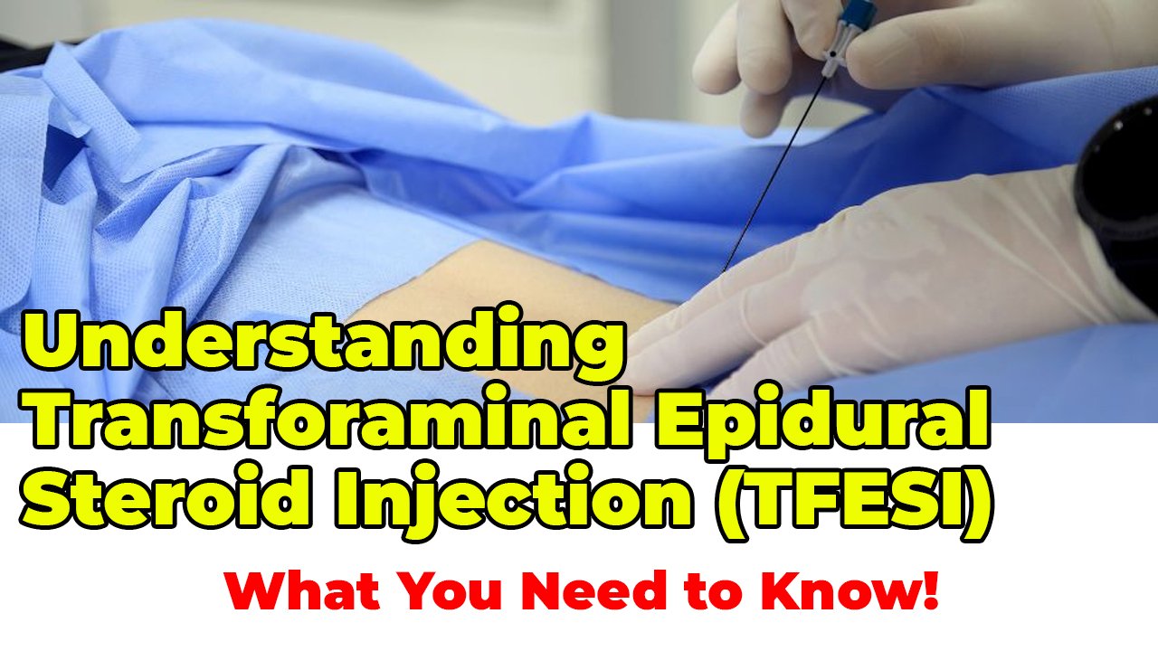 Understanding Transforaminal Epidural Steroid Injection (TFESI): What You Need to Know!