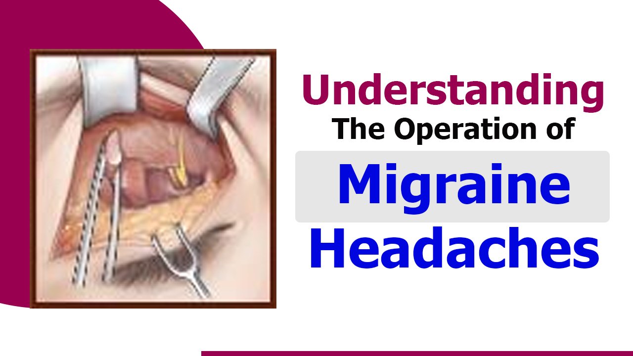 Understanding the Operation of Migraine Headaches