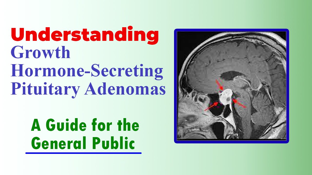 Understanding Growth Hormone-Secreting Pituitary Adenomas. A Guide for the General Public.